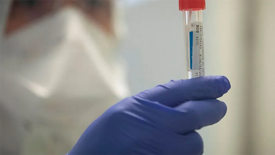 coronavirus