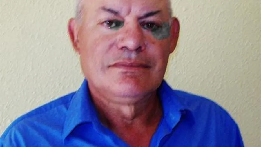 Armando Brumatti.