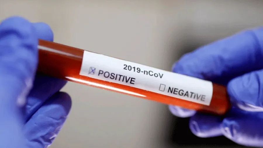 Coronavirus.