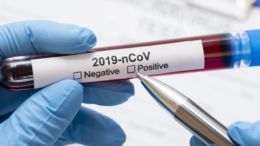 coronavirus 
