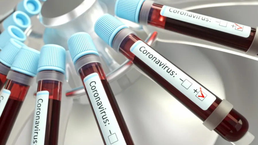 coronavirus 
