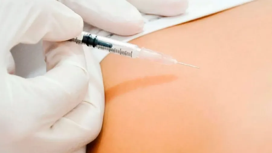 Carboxiterapia