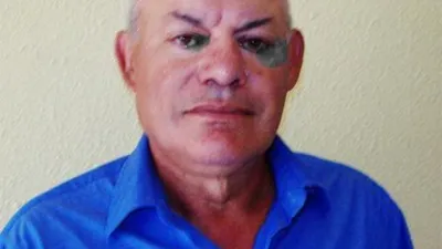 Armando Brumatti.