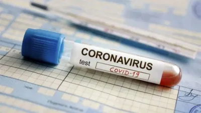Paraná con 48 nuevos casos y un acumulado de 2.597 sigue siendo el Departamento con más coronavirus de Entre Ríos; seguido de Gualeguaychú con 13 nuevos casos y un acumulado de 821.