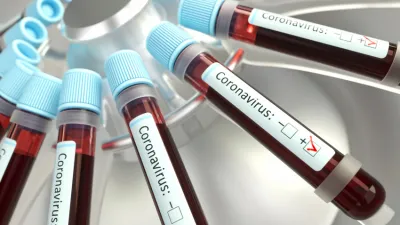 coronavirus