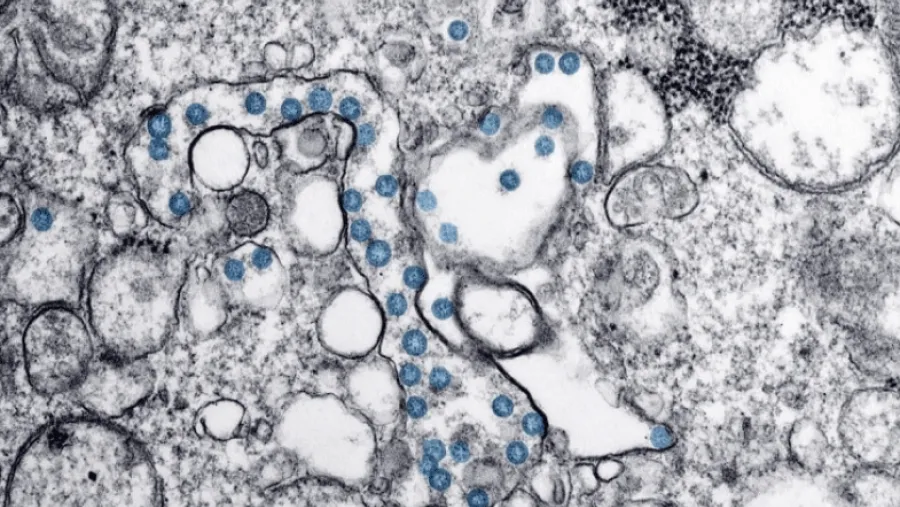 Coronavirus.