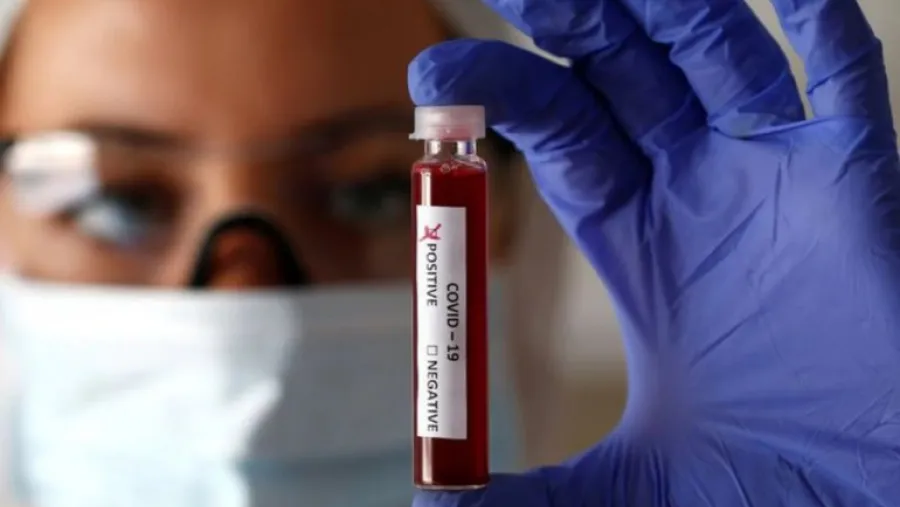 coronavirus laboratorio