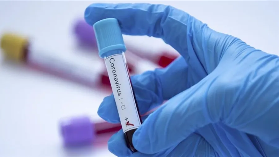 coronavirus laboratorio coronavirus laboratorio