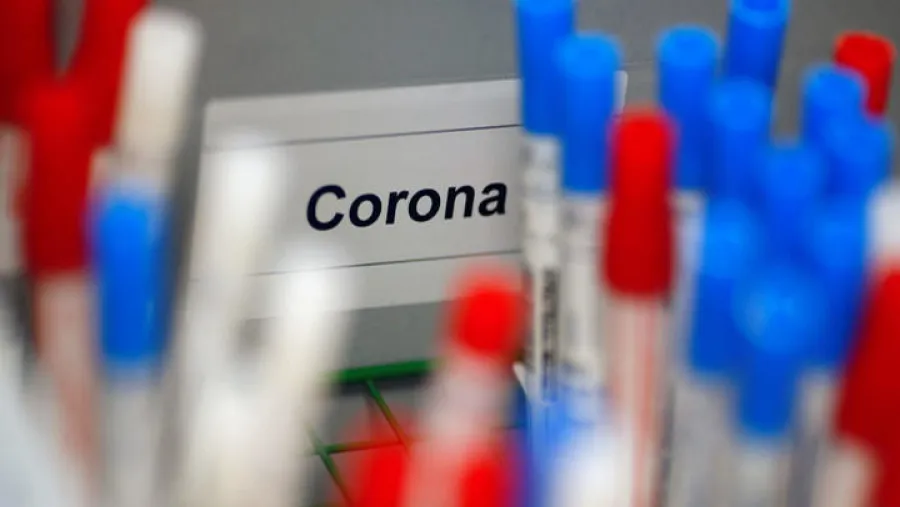 coronavirus muestras