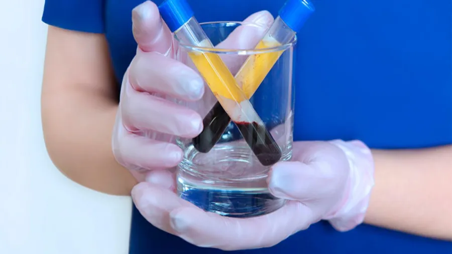 coronavirus muestras