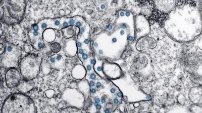 Coronavirus.