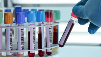 El Colegio de Bioquímicos de Entre Ríos confirmó que a partir de hoy los afiliados al Iosper no contarán con cobertura. Reprochan la falta de diálogo de la gestión interventora.