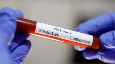 Coronavirus.