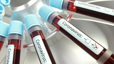 Coronavirus