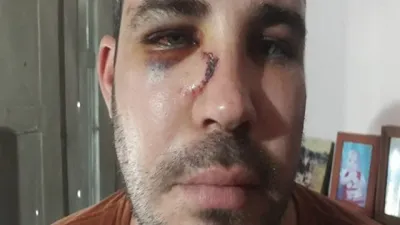 joven denuncia golpiza policial