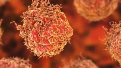 Sistema inmunológico